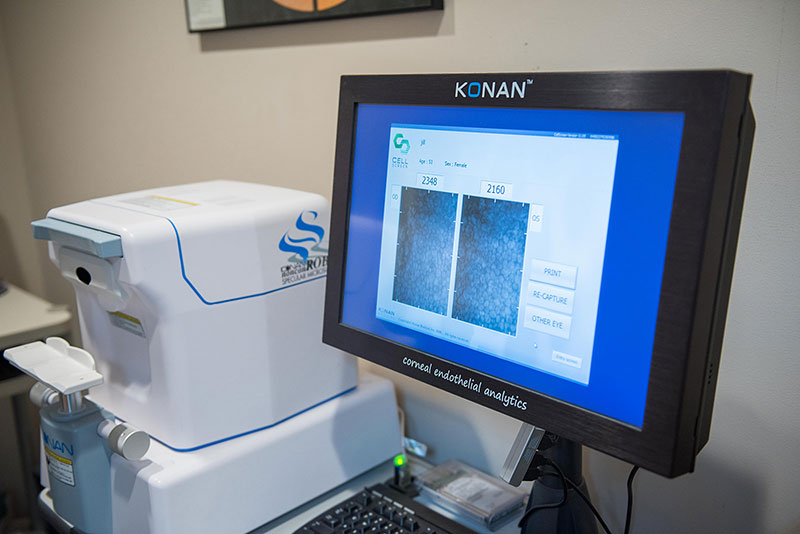 Specular Microscope